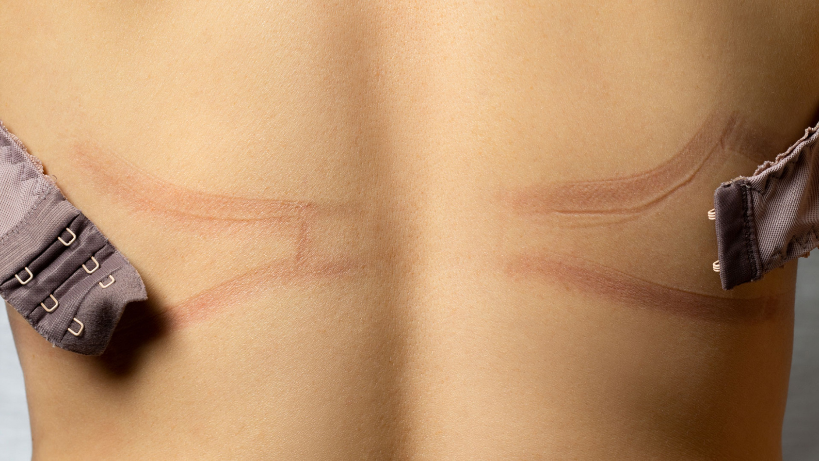 Vad händer i kroppen när BH:n inte ger rätt stöd?